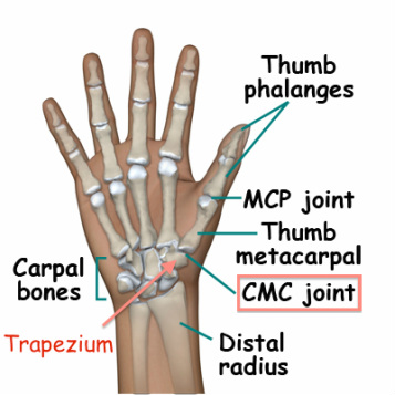 Do You Suffer from Thumb Pain?