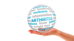 How to Exercise with Arthritis