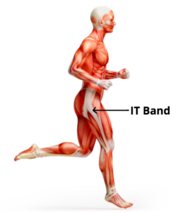 Select Chiropractic and Wellness — IT Band Syndrome