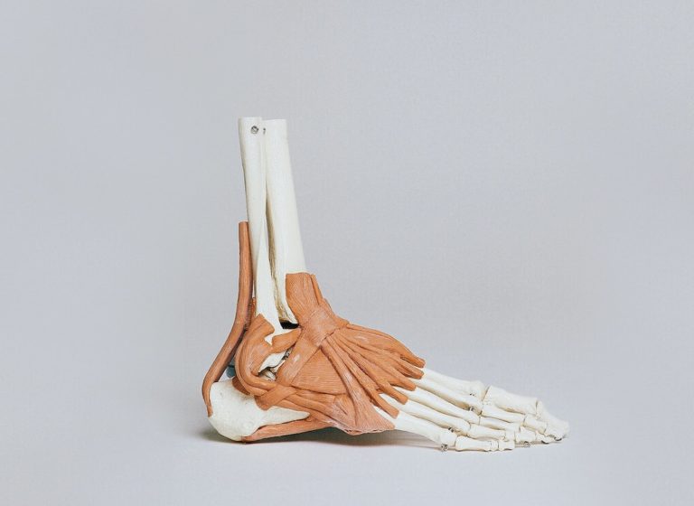 My Hips and Feet are Connected?! Innovative Physical Therapy